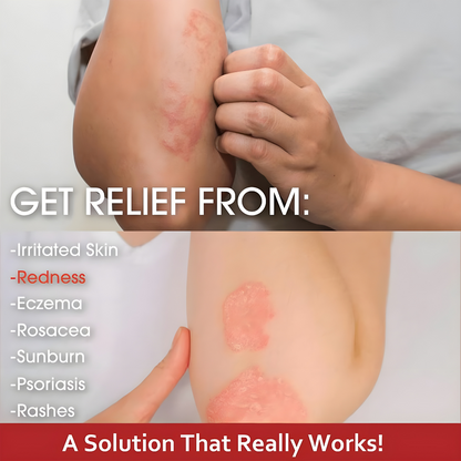 Herbal Relief Cream
